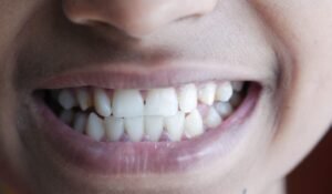 How to Strengthen Teeth Naturally — How to Strengthen Teeth Naturally: Ancient Wisdom & New Science — Photo by Towfiqu barbhuiya on Pexels
