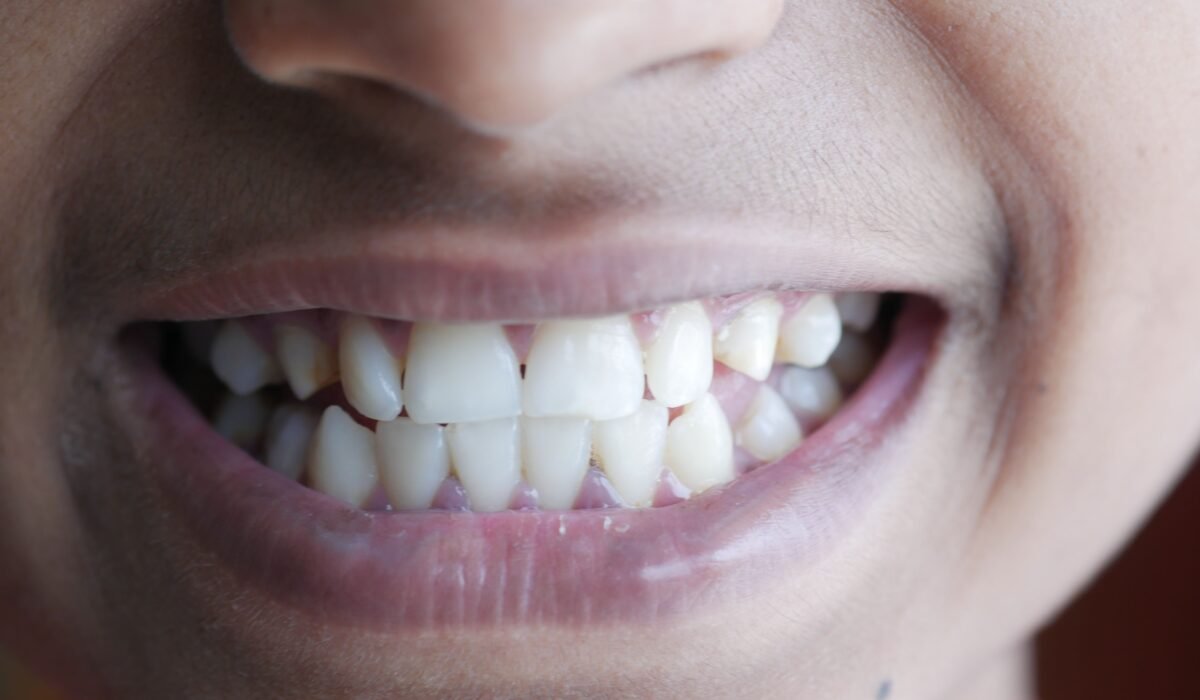 How to Strengthen Teeth Naturally — How to Strengthen Teeth Naturally: Ancient Wisdom & New Science — Photo by Towfiqu barbhuiya on Pexels